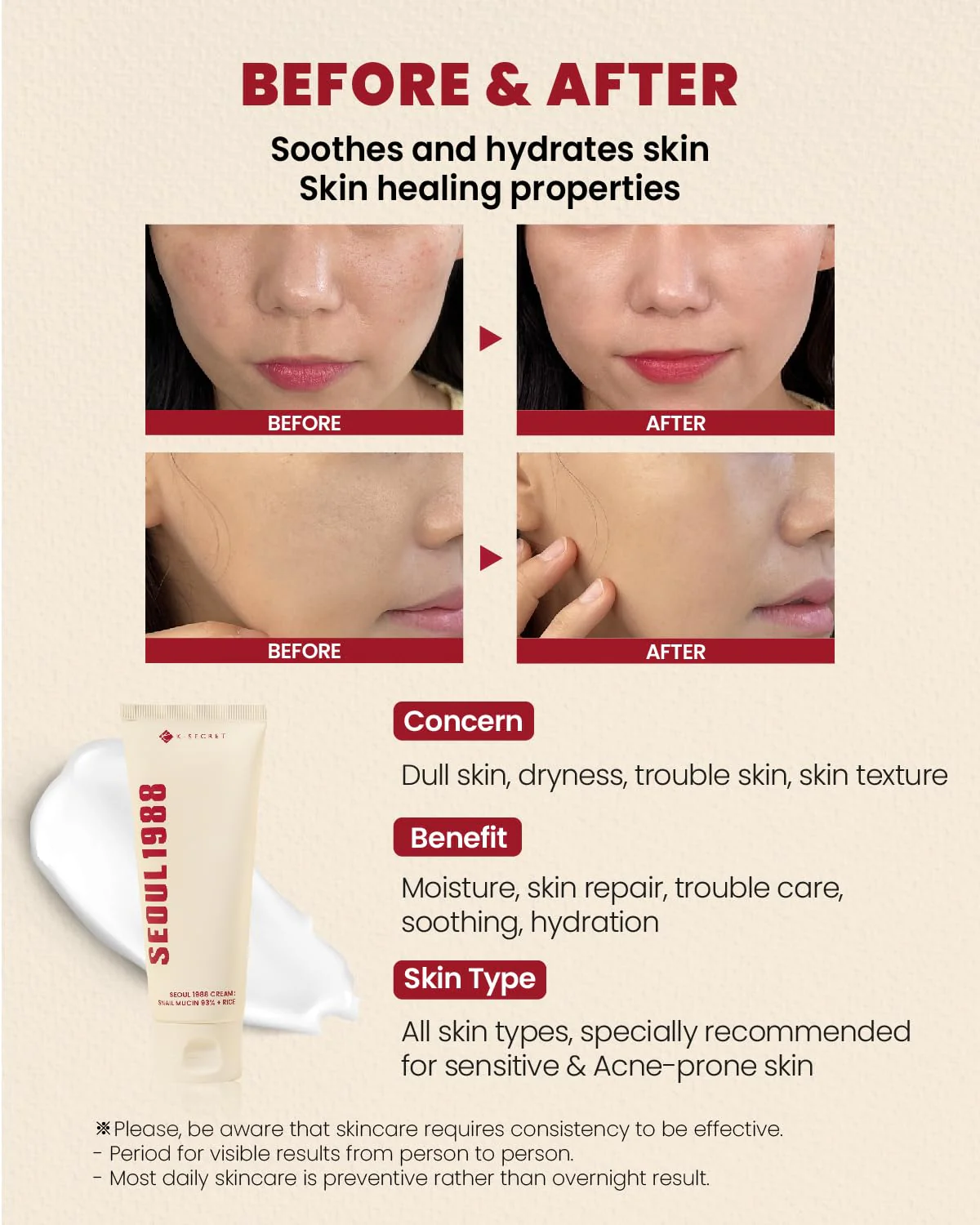 K-SECRET SEOUL 1988 Cream: Snail Mucin 93% + Rice (100ml) - Image 4
